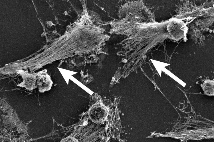 microscopy image of NETs