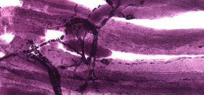 A microscopy image of neuromuscular junctions with projections from the neurons (grey/black) connecting to the muscles (purple).