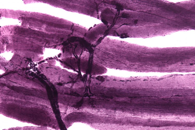 A microscopy image of neuromuscular junctions with projections from the neurons (grey/black) connecting to the muscles (purple).
