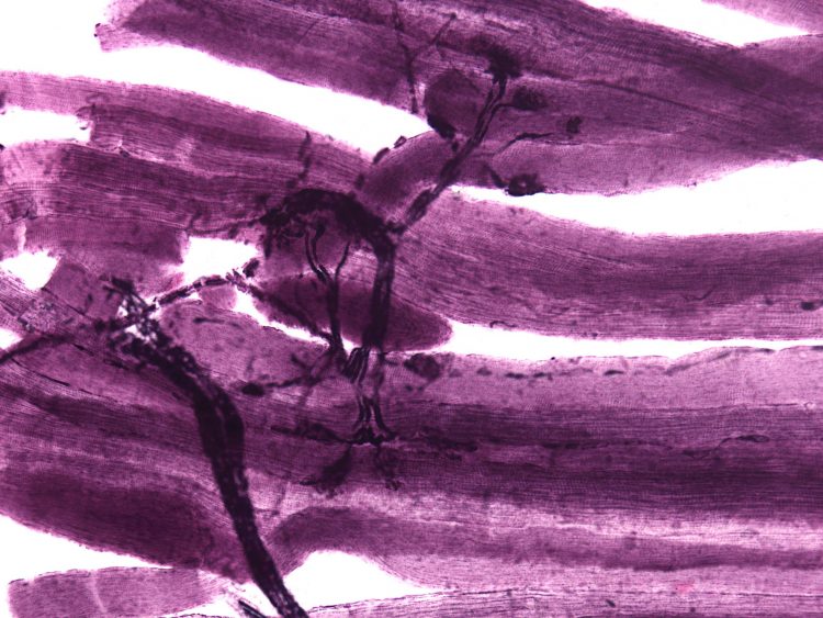 A microscopy image of neuromuscular junctions with projections from the neurons (grey/black) connecting to the muscles (purple).