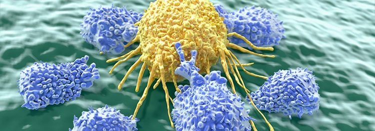 Melanoma