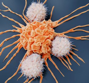Natural killer cells and cancer