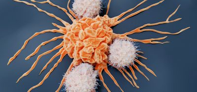 Natural killer cells and cancer