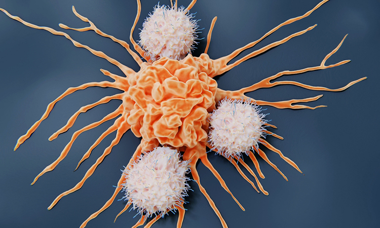 Natural killer cells and cancer