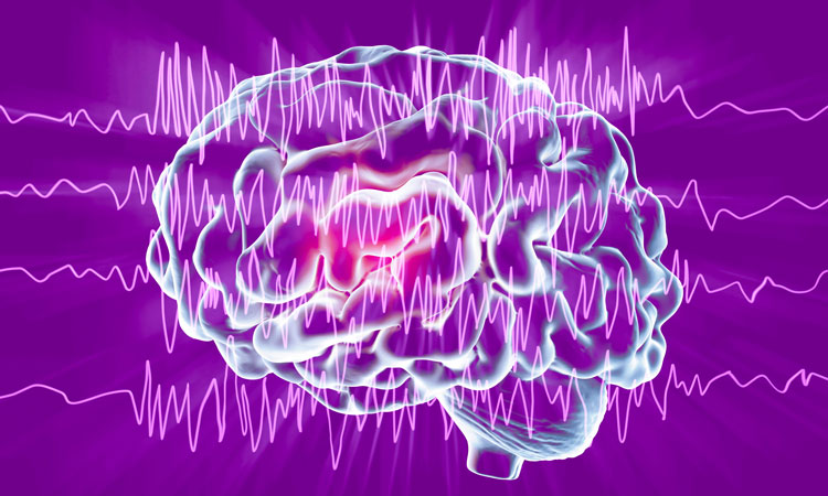 New therapy stops seizures in mouse model of rare childhood epilepsy