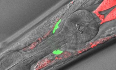New worm model could aid in the study of rare disease