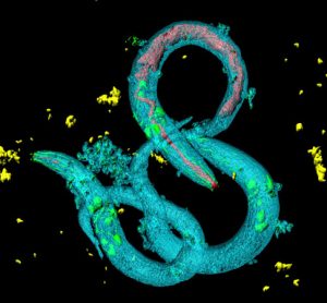 New worm model could aid in the study of rare disease1