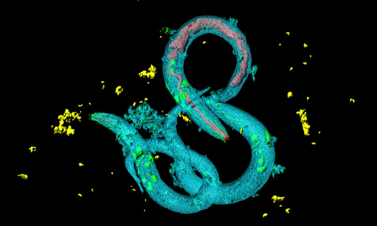 New worm model could aid in the study of rare disease1