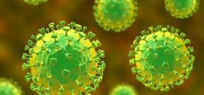 Nipah virus