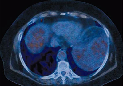 Oncologic imaging