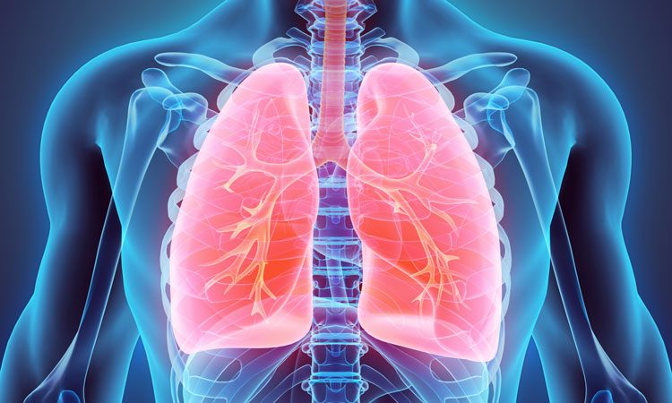 pulmonary artery hypertension