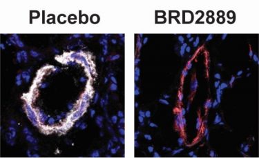 Rodent blood vessels treated with placebo on left and BRD2889 on right