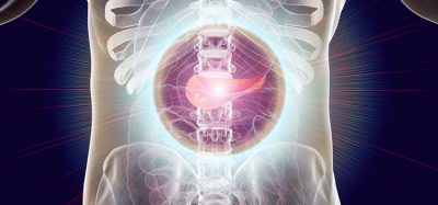 Pancreatic cancer