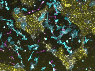  Parallel conversion of induced pluripotent stem cells (iPS) into vascular, nerve and connective tissue cells: Three transgenic iPS lines, in each of which a different transcription factor can be activated, were mixed and induced to form a defined synthetic tissue within four days. Vascular cells are stained yellow, nerve cells magenta and connective tissue cells blue [Credit: © Jesus Eduardo Rojo Arias und Volker Busskamp].