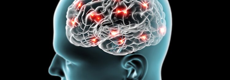 Brain with Parkinson's