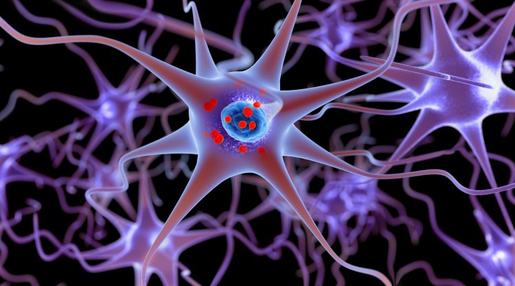 3D rendering of neurons containing alpha-synuclein Lewy Bodies
