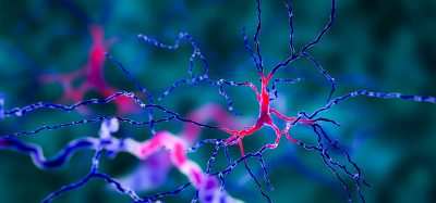 Computer recreation of dopaminergic neurons (involved in Parkinson's) in blue and pink