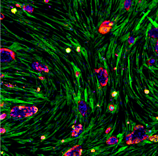 Single-cell analysis of multi-cellular cultures and organoids containing multiple distinct cell types can provide a more physiologically-relevant model of disease to improve drug discovery [Credit: Phenomic AI.]