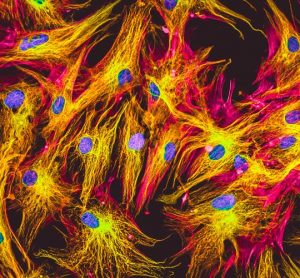 Real fluorescence microscopic view of human fibroblasts in culture. Nucleus are in blue, actin filaments are in pink, tubulin was labelled with green.