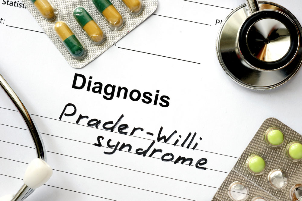 Prader-Willi syndrome