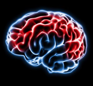 Rasmussen's encephalitis