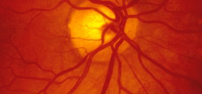Inside of retina