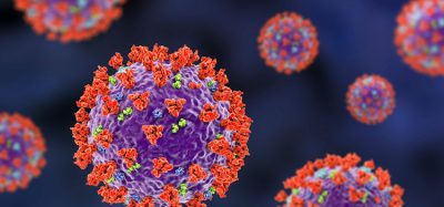 SARS-CoV-2, the coronavirus that causes COVID-19, 3D illustration shows surface spikes of the virus Glycoprotein S (red), M-protein (light green), E-protein (blue)