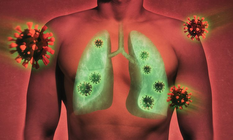 SARS-CoV-2 in lungs