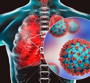 Lungs with a cutaway closeup of a SARS-CoV-2 particle in blue with red cell surface proteins