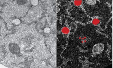 A portion of an infected cell is observed by transmission electron microscopy, in which SARS-CoV-2-specific structures (in red, from the mirrored image on the right) can be detected as early as six hours after infection. The virus's genome is replicated in high copy number in two membrane layers forming a big balloon (large structures in red), which forms a very shielded compartment. New virions (small structures in red) are being formed by budding at the interface of the endoplasmic reticulum and Golgi apparatus [Credit: Yannick Schwab/EMBL].
