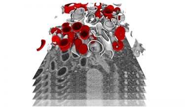 Infected cells were imaged by focused ion beam scanning electron microscopy, a powerful technique to reveal the organisation of a cell at the subcellular level in 3D. In this image, a subvolume of one cell was segmented to display membrane-bound organelles (in grey) and double-membrane vesicles (in red) - a virus-specific compartment where the viral genome is replicated in large quantities [Credit: Julian Hennies/EMBL].
