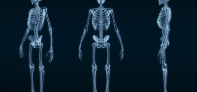 Skeleton