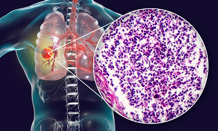 rat mesothelioma cells