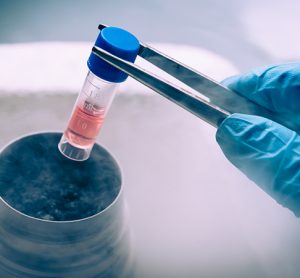 Stem cells in container