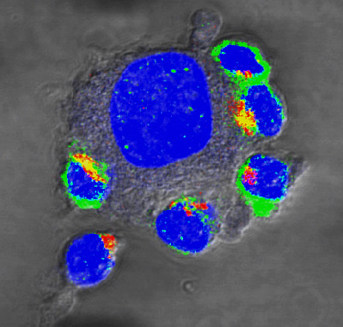 T-cells armed for aggression