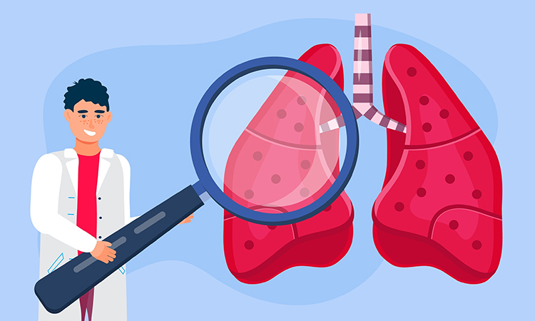 Phthisiologist, pulmonologist looks through a magnifying glass at lungs. Scene of tuberculosis, pneumonia concept vector.