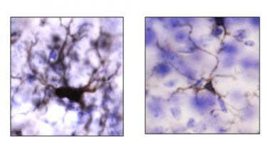 Neuron comparison before ad after CSF-1R inhibitor treatment