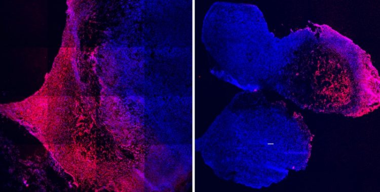 Bioluminescence imaging showing that when the chemotherapy doxorubicin (red) was bound to the tumour-infiltrating molecule iRGD, it effectively infiltrated triple-negative breast cancer tumours (blue) to attack them (left). Dox without this modification remained mostly within the hydrogel and did not migrate into the tumours (right) [Credit: Wyss Institute at Harvard University].