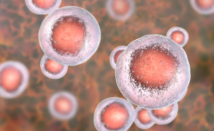 Phenotypic screening using iPSC-based human disease biology