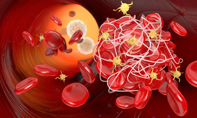 Antibodies to combat thrombosis