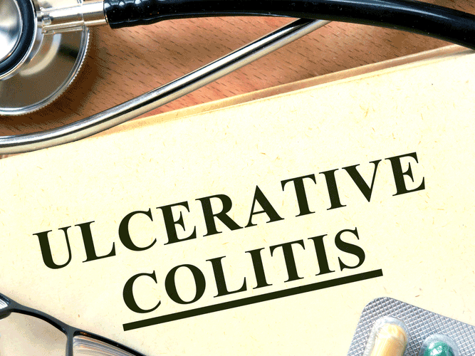 Ulcerative Colitis