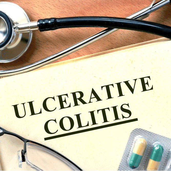 Ulcerative Colitis