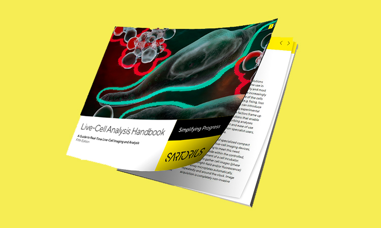 Sartorius analysis