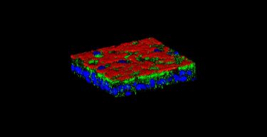 The protein Vav3 (in green) creates «bacterial docking stations» on the surface (in red) of respiratory cells (nuclei in blue) that facilitate airways' infection in patients with cystic fibrosis [Credit: © UNIGE, laboratoire Chanson].