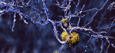 neurons in purple surrounded by yellow protein aggregates - idea of Alzheimer's disease