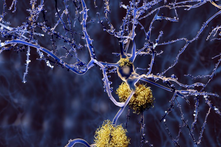 neurons in purple surrounded by yellow protein aggregates - idea of Alzheimer's disease