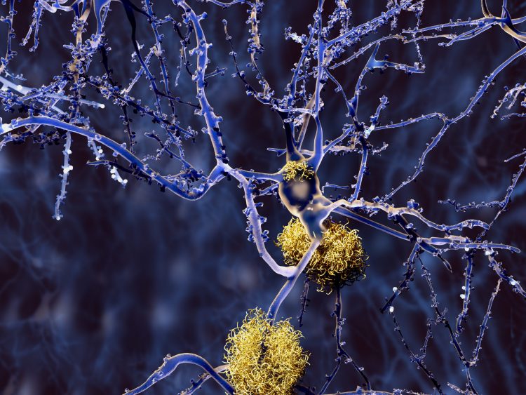 neurons in purple surrounded by yellow protein aggregates - idea of Alzheimer's disease