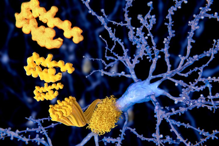 amyloid plaque forming on a neuron