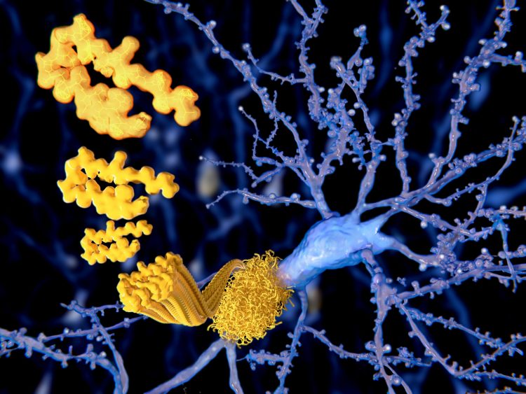 amyloid plaque forming on a neuron