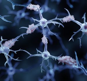 amyloid aggregates